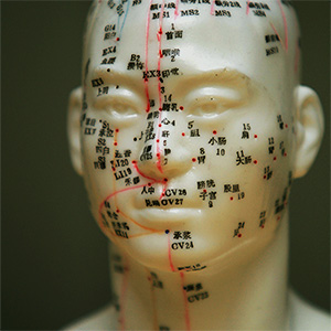 acupunture_head